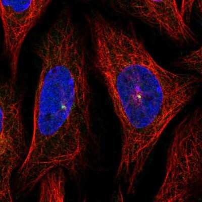 Immunocytochemistry/Immunofluorescence: AHI1 Antibody [NBP2-55373] - Staining of human cell line SiHa shows localization to centrosome.