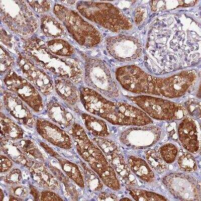 Immunohistochemistry-Paraffin AHI1 Antibody