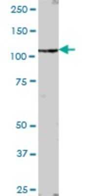 Western Blot: AHI1 Antibody [H00054806-B01P] - Analysis of AHI1 expression in human placenta.