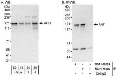 Western Blot AHI1 Antibody