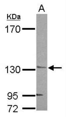 Western Blot: AHI1 Antibody [NBP2-15310] - Sample (30 ug of whole cell lysate) A: NT2D1 7. 5% SDS PAGE; antibody diluted at 1:1000.