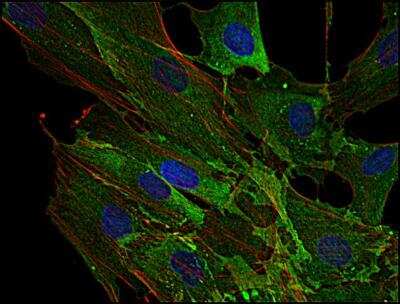 Immunocytochemistry/Immunofluorescence: AHNAK Antibody (EM-09) [NBP2-62204] - Staining of AHNAK1 in human primary fibroblasts using anti-AHNAK1 (EM-09; green). Actin filaments were decorated by phalloidin (red) and cell nuclei stained with DAPI (blue).