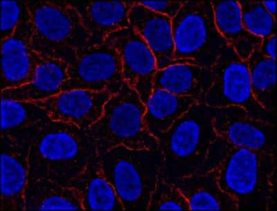 Immunocytochemistry/Immunofluorescence: AHNAK Antibody (EM-09) [NBP2-62204] - Staining of AHNAK1 in HeLa cell line using anti-AHNAK1 (EM-09; red). Cell nuclei stained with DAPI (blue).