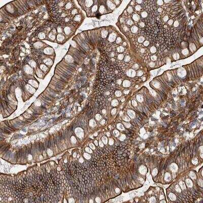 Immunohistochemistry-Paraffin: AHNAK Antibody [NBP1-81058] - Staining of human small intestine shows strong membranous and cytoplasmic positivity in glandular cells.