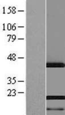 Western Blot: AHNAK Overexpression Lysate (Adult Normal) [NBP2-06357] Left-Empty vector transfected control cell lysate (HEK293 cell lysate); Right -Over-expression Lysate for AHNAK.