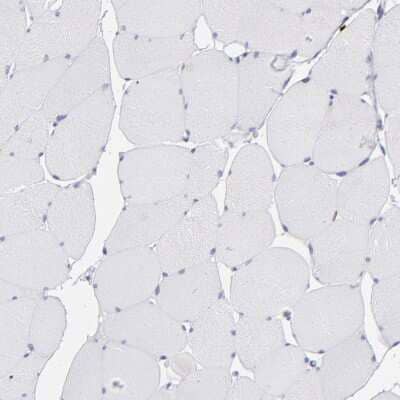 Immunohistochemistry-Paraffin: AHNAK2 Antibody [NBP1-88428] - Staining of human skeletal muscle shows no positivity in myocytes as expected.