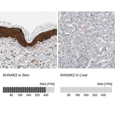 <b>Orthogonal Strategies Validation. </b>Immunohistochemistry-Paraffin: AHNAK2 Antibody [NBP1-88429] - Staining in human skin and liver tissues using anti-AHNAK2 antibody. Corresponding AHNAK2 RNA-seq data are presented for the same tissues.