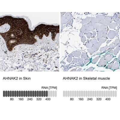 Immunohistochemistry-Paraffin: AHNAK2 Antibody [NBP2-47554] - Staining in human skin and skeletal muscle tissues using NBP2-47554 antibody. Corresponding AHNAK2 RNA-seq data are presented for the same tissues.