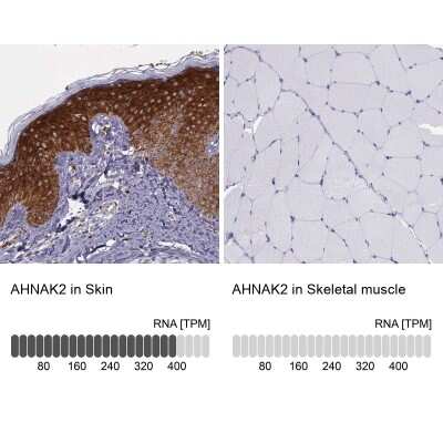 Immunohistochemistry-Paraffin: AHNAK2 Antibody [NBP2-48488] - Staining in human skin and skeletal muscle tissues using NBP2-48488 antibody. Corresponding AHNAK2 RNA-seq data are presented for the same tissues.
