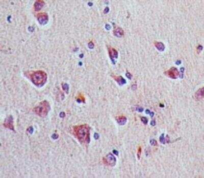 Immunohistochemistry-Paraffin: AHR Antibody [NBP2-27296] - Formalin-fixed, paraffin-embedded normal human brain tissue stained with Aryl hydrocarbon Receptor antibody (5 ug/ml), peroxidase-conjugate and DAB chromogen.
