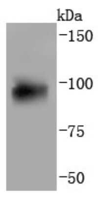 Western Blot: AHR Antibody (JM34-10) [NBP2-67125] - Analysis of AhR on human lung lysates using anti-AhR antibody at 1/1,000 dilution.