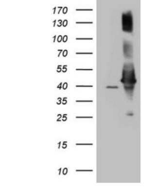 Western Blot: AHSA1 Antibody (OTI1D2) - Azide and BSA Free [NBP2-71608] - HEK293T cells were transfected with the pCMV6-ENTRY control (Left lane) or pCMV6-ENTRY AHSA1 (Right lane) cDNA for 48 hrs and lysed. Equivalent amounts of cell lysates (5 ug per lane) were separated by SDS-PAGE and immunoblotted with antiAHSA1.(1:2000)