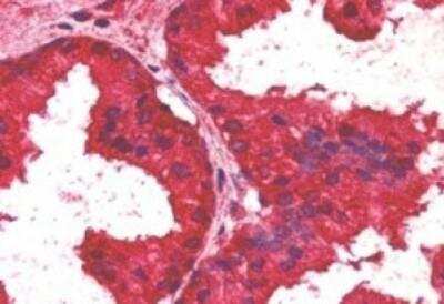 Immunohistochemistry-Paraffin: AIBZIP Antibody [NB100-1015] - IHC analysis of AIBZIP in paraffin embedded Human Prostate using this antibody at 2.5ug/ml. Steamed antigen retrieval with citrate buffer pH 6, AP-staining.