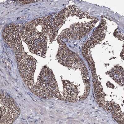 Immunohistochemistry-Paraffin: AIBZIP Antibody [NBP1-90205] - Staining of human prostate shows high expression.