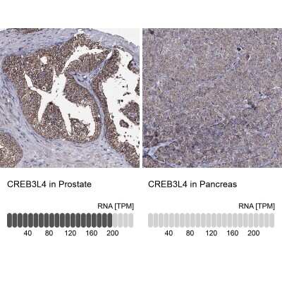Immunohistochemistry-Paraffin AIBZIP Antibody - BSA Free