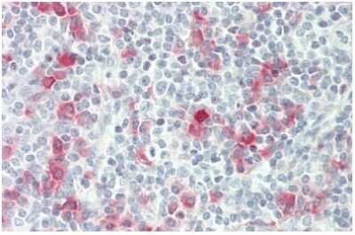 Immunohistochemistry-Paraffin: AICDA Antibody [NBP3-10976] - Immunohistochemistry with formalin-fixed paraffin-embedded human tonsil tissue at an antibody concentration of 10 ug/ml.