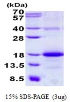 SDS-PAGE Recombinant Human AICL/CLEC-2B His Protein