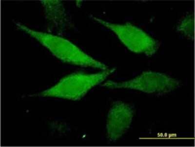 Immunocytochemistry/Immunofluorescence: AIDA Antibody (2E6-1C11) [H00064853-M01] - Analysis of monoclonal antibody to C1orf80 on HeLa cell. Antibody concentration 60 ug/ml.