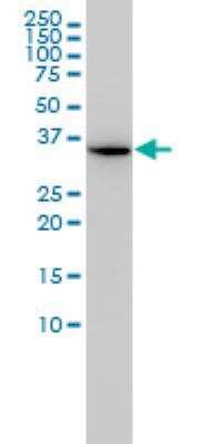 Western Blot: AIDA Antibody (2E6-1C11) [H00064853-M01] - FLJ12806 monoclonal antibody (M01), clone 2E6-1C11 Western Blot analysis of FLJ12806 expression in Hela ( Cat # L013V1 ).