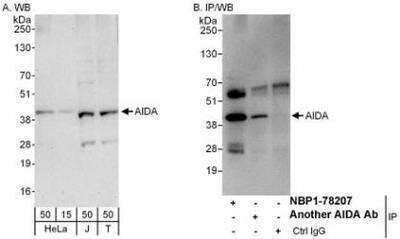 Western Blot: AIDA Antibody [NBP1-78207] - Whole cell lysate from HeLa (15 and 50 mcg for WB; 1 mg for IP, 20% of IP loaded), Jurkat (J; 50 mcg) and 293T (T; 50 mcg) cells. Affinity purified rabbit anti-AIDA antibody used for WB at 0.04 mcg/ml (A) and 0.4 mcg/ml (B) and used for IP at 6 mcg/mg lysate.  AIDA was also immunoprecipitated by another rabbit anti-AIDA antibody which recognizes a downstream epitope.