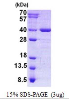 SDS-Page: AIDA Protein [NBP2-22703]