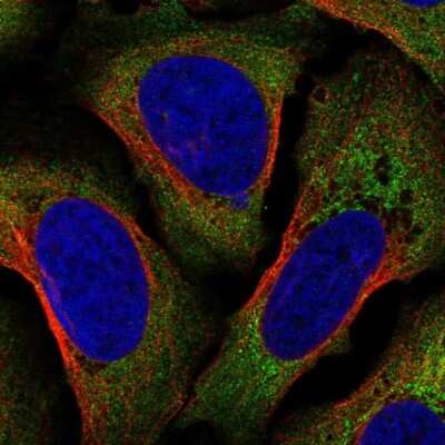 Immunocytochemistry/Immunofluorescence: AIF-1/Iba1 Antibody [NBP2-68800] - Staining of human cell line U-2 OS using FANCD2 Antibody shows localization to cytosol.