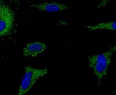 Immunocytochemistry/Immunofluorescence: AIF-1/Iba1 Antibody (JM36-62) [NBP2-75397] - Staining AIF-1/Iba1 in SH-SY5Y cells using (green). The nuclear counter stain is DAPI (blue). Cells were fixed in paraformaldehyde, permeabilised with 0.25% Triton X-100, PBS.