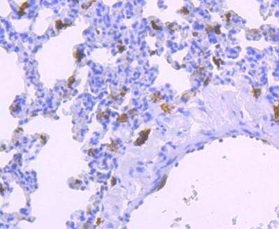 Immunohistochemistry-Paraffin: AIF-1/Iba1 Antibody (JM36-62) [NBP2-75397] - Analysis of paraffin-embedded rat lung tissue using AIF-1/Iba1 Antibody (JM36-62). Counterstained with hematoxylin.