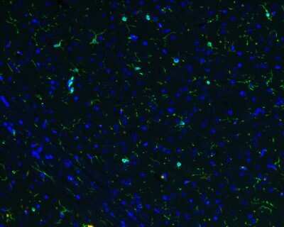 Immunohistochemistry-Paraffin: AIF-1/Iba1 Antibody (JM36-62) [NBP2-75397] - Immunofluorescence staining of paraffin- embedded mouse brain tissue using anti-AIF-1/Iba1 antibody.The section was pre-treated using heat mediated antigen retrieval with Tris-EDTA buffer (pH 9.0) for 20 minutes. The tissues were blocked in 10% negative goat serum for 1 hour at room temperature, washed with PBS, and then probed with at 1/50 dilution for 10 hours at 4 and detected using Alexa Fluor(R) 488 conjugate-Goat anti-Rabbit IgG (H+L) Secondary Antibody at a dilution of 1:500 for 1 hour at room temperature.