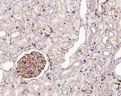 Immunohistochemistry-Paraffin: AIF-1/Iba1 Antibody (JM36-62) [NBP2-75397] - Analysis of paraffin-embedded human kidney tissue with Rabbit anti-AIF-1/Iba1 antibody. The section was pre-treated using heat mediated antigen retrieval with Tris-EDTA buffer (pH 9.0) for 20 minutes. The tissues were blocked in 1% BSA for 20 minutes at room temperature, washed with ddH2O and PBS, and then probed with the primary antibody for 1 hour at room temperature. The detection was performed using an HRP conjugated compact polymer system. DAB was used as the chromogen. Tissues were counterstained with hematoxylin and mounted with DPX.