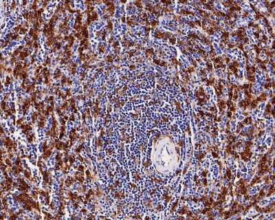 Immunohistochemistry-Paraffin: AIF-1/Iba1 Antibody (JM36-62) [NBP2-75397] - Analysis of paraffin-embedded human spleen tissue with Rabbit anti-AIF-1/Iba1 antibody. The section was pre-treated using heat mediated antigen retrieval with Tris-EDTA buffer (pH 9.0) for 20 minutes. The tissues were blocked in 1% BSA for 20 minutes at room temperature, washed with ddH2O and PBS, and then probed with the primary antibody for 1 hour at room temperature. The detection was performed using an HRP conjugated compact polymer system. DAB was used as the chromogen. Tissues were counterstained with hematoxylin and mounted with DPX.