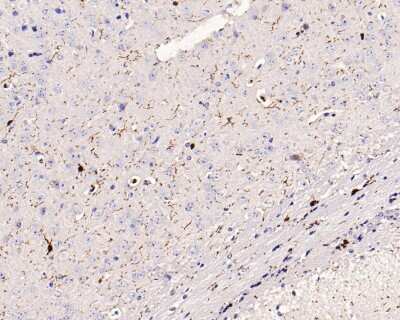 Immunohistochemistry-Paraffin: AIF-1/Iba1 Antibody (JM36-62) [NBP2-75397] - Analysis of paraffin-embedded mouse brain tissue with Rabbit anti-Iba1 antibody. The section was pre-treated using heat mediated antigen retrieval with Tris-EDTA buffer (pH 9.0) for 20 minutes. The tissues were blocked in 1% BSA for 20 minutes at room temperature, washed with ddH2O and PBS, and then probed with the primary antibody for 1 hour at room temperature. The detection was performed using an HRP conjugated compact polymer system. DAB was used as the chromogen. Tissues were counterstained with hematoxylin and mounted with DPX.