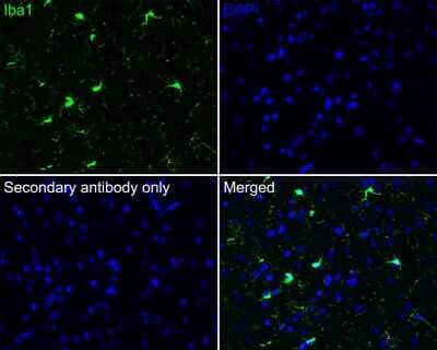 Immunohistochemistry-Paraffin: AIF-1/Iba1 Antibody (JM36-62) [NBP2-75397] - Immunofluorescence analysis of paraffin-embedded rat brain tissue labeling Iba1 with Rabbit anti-AIF-1/Iba1 antibody washed with PBS, and then probed with the primary antibody (green) at 1/100 dilution overnight at 4 , washed with PBS. Goat Anti-Rabbit IgG H&L (iFluor(TM) 488) was used as the secondary antibody at 1/1,000 dilution. Nuclei were counterstained with DAPI (blue).