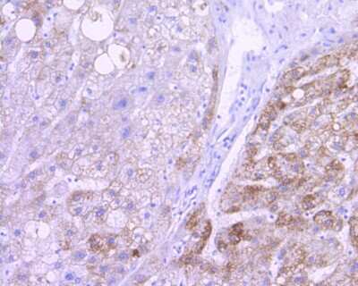 Immunohistochemistry-Paraffin: AIF Antibody (SZ05-01) [NBP2-67366] - Analysis of paraffin-embedded human liver tissue using anti-AIF antibody. The section was pre-treated using heat mediated antigen retrieval with Tris-EDTA buffer (pH 8.0-8.4) for 20 minutes. The tissues were blocked in 5% BSA for 30 minutes at room temperature, washed with ddH2O and PBS, and then probed with the primary antibody (1/200) for 30 minutes at room temperature. The detection was performed using an HRP conjugated compact polymer system. DAB was used as the chromogen. Tissues were counterstained with hematoxylin and mounted with DPX.