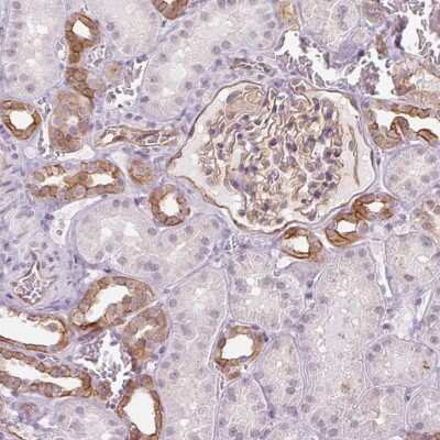 Immunohistochemistry: AIF1L Antibody [NBP2-38808] - Staining of human kidney shows moderate cytoplasmic and membranous positivity in cells in tubules and glomeruli.