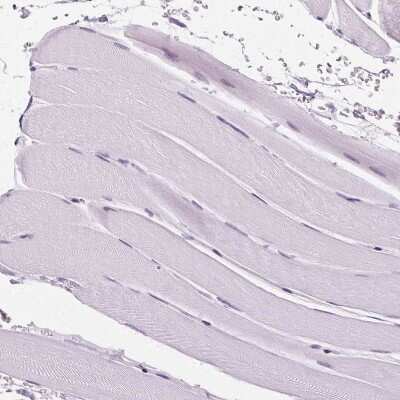 <b>Orthogonal Strategies Validation. </b>Immunohistochemistry-Paraffin: AIF1L Antibody [NBP2-32004] - Staining of human skeletal muscle shows no positivity in myocytes as expected.