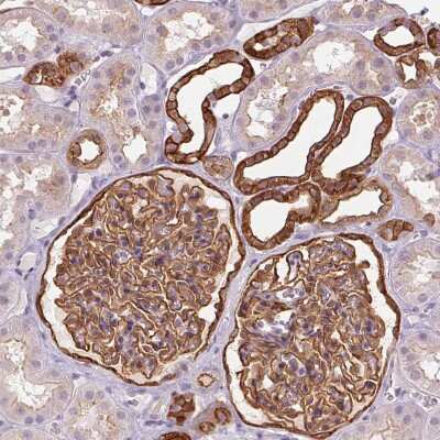 Immunohistochemistry-Paraffin: AIF1L Antibody [NBP2-32004] - Staining of human kidney shows strong cytoplasmic positivity in cells in glomeruli.