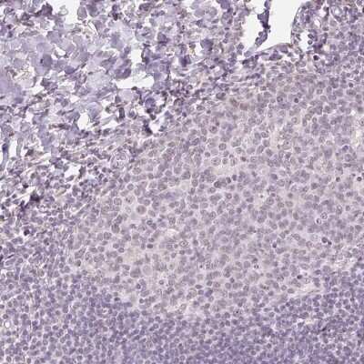 Immunohistochemistry-Paraffin AIF1L Antibody - BSA Free