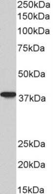 Western Blot: AIM2 Antibody (10M2B3) - Azide and BSA Free [NBP2-80566] - Western blot analysis of Daudi lysate (35 ug per lane, RIPA buffer) using AIM2 antibody (NBP2-27355) at 0.3ug/ml. Band observed at ~38kDa. (Expected MW of 39.0kDa according to NP_004824.1) Image from the standard format of this antibody.