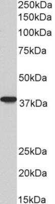 Western Blot: AIM2 Antibody (10M2B3) [NBP2-27355] - Western blot analysis of Daudi lysate (35 ug per lane, RIPA buffer) using AIM2 antibody (NBP2-27355) at 0.3ug/ml. Band observed at ~38kDa. (Expected MW of 39.0kDa according to NP_004824.1)