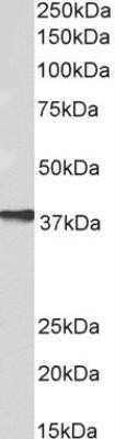 Western Blot: AIM2 Antibody (10M5G5) - Azide and BSA Free [NBP2-80565] - Western blot analysis of Daudi lysate (35 ug per lane, RIPA buffer) using AIM2 antibody (NBP2-27354) at 0.1ug/ml. Band observed at ~38kDa. (Expected MW of 39.0kDa according to NP_004824.1). Image from the standard format of this antibody.