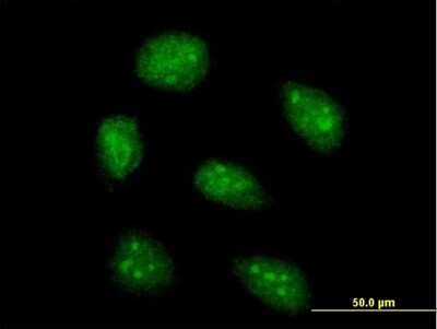 Immunocytochemistry/Immunofluorescence: AIM2 Antibody [H00009447-B01P] - Analysis of purified antibody to AIM2 on HeLa cell. (antibody concentration 10 ug/ml)