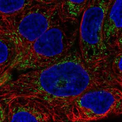 Immunocytochemistry/Immunofluorescence: AIM2 Antibody [NBP2-55560] - Staining of human cell line RT4 shows localization to mitochondria. Antibody staining is shown in green.