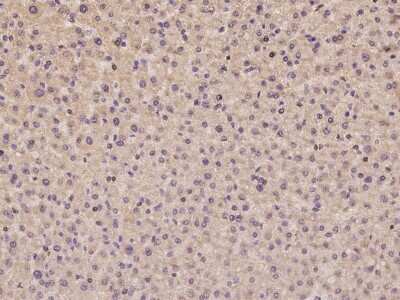 Immunohistochemistry-Paraffin: AIM2 Antibody [NBP2-97404] - Immunochemical staining of human AIM2 in human liver with rabbit polyclonal antibody at 1:100 dilution, formalin-fixed paraffin embedded sections.