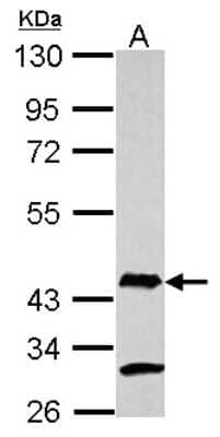 Western Blot: AIM2 Antibody [NBP2-15313] - Sample (30 ug of whole cell lysate) A: MCF-7 10% SDS PAGE; antibody diluted at 1:1000.