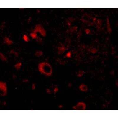 Immunocytochemistry/Immunofluorescence: AIPL1 Antibody [NBP1-76953] - Immunofluorescence of aipl1 in human brain tissue with aipl1 antibody at 20 ug/mL.