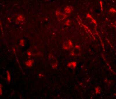 Immunocytochemistry/Immunofluorescence: AIPL1 Antibody [NBP1-76956] - Immunofluorescence of aipl1 in human brain tissue with aipl1 antibody at 20 ug/mL.