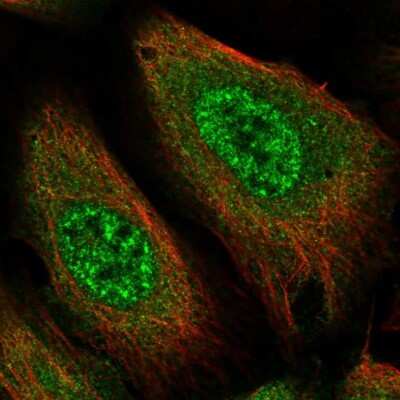 Immunocytochemistry/Immunofluorescence: AIPL1 Antibody [NBP2-55506] - Staining of human cell line U-2 OS shows localization to nucleoplasm & cytosol.