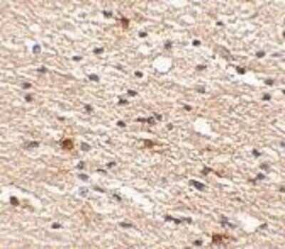 Immunohistochemistry-Paraffin: AIPL1 Antibody [NBP1-76953] - Human brain tissue with Aipl1 antibody at 2.5 ug/ml.