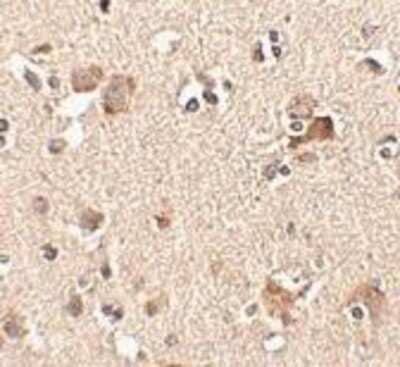 Immunohistochemistry-Paraffin: AIPL1 Antibody [NBP1-76956] - Human brain tissue with Aipl1 antibody at 2.5 ug/ml.